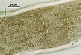 5 – Cellule corticali in visione superficiale